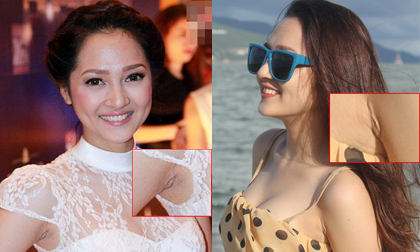 Bảo Anh lộ vết tích 'dao kéo' vòng ngực?