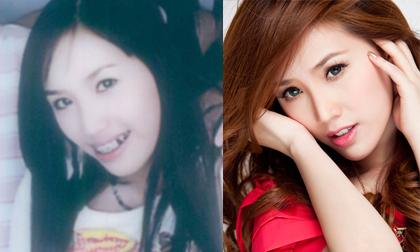 Bảo Thy và "cuộc lột xác ngoạn mục" từ hàm răng tới mái tóc