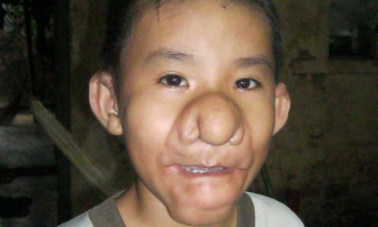 Sự sống gian nan của 'em bé Trư Bát Giới'