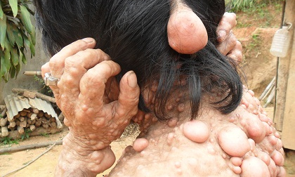 Ba cha con mang hình hài... của quỷ