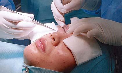 Phim Hồng Kông gây sốc với cảnh phẫu thuật thẩm mỹ thật