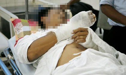 Phó công an xã thuê côn đồ chém trưởng CA