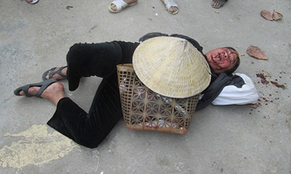 Con trai bí thư xã đánh dã man một cụ già