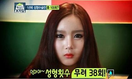 "Sốc" với những cô gái phẫu thuật thẩm mỹ gần 40 lần/năm