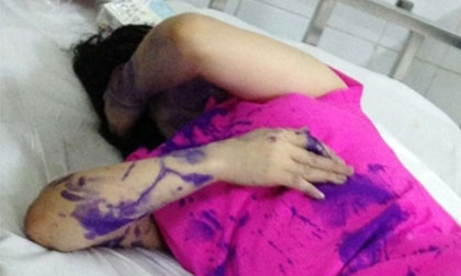 Một phụ nữ bị đổ mực vào mồm, đánh bất tỉnh