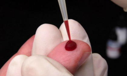 Virut mới nguy hiểm hơn HIV đang lây lan nhanh chóng ở Nga