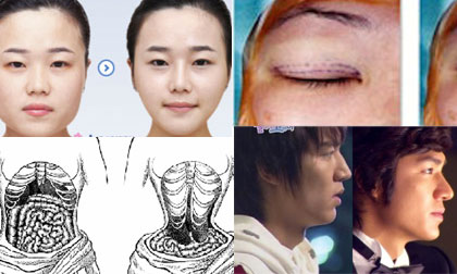 Top 6 phương pháp phẫu thuật thẩm mỹ được ưa thích nhất