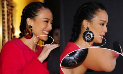 Thư Kỳ lộ '2 cằm' vì béo hay phẫu thuật?