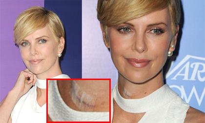 Charlize Theron liên tục "che đậy" vết rạch khó hiểu ở cổ