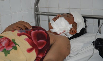 Vụ xà beng đâm xuyên đầu: Phút sinh tử qua lời kể