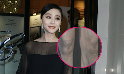 Phạm Băng Băng bớt rạng ngời vì lộ chân đầy sẹo 