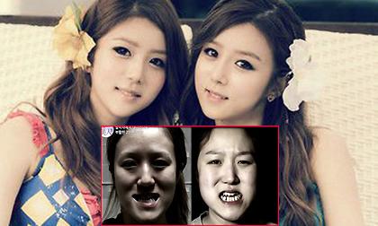 Sốc trước màn "vịt hoá thiên nga" sau thẩm mỹ của chị em sinh đôi xứ Hàn