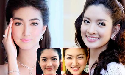 Loạt mỹ nhân Thái "phát cuồng" với mốt cắt mí mắt
