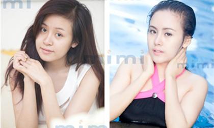 Hé lộ 'đại gia thẩm mỹ Việt ' phẫu thuật cho Bà Tưng