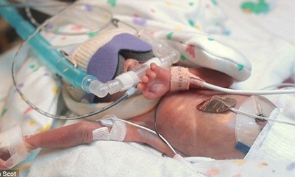 Hành trình sống thần kì của cậu bé sinh non 680g