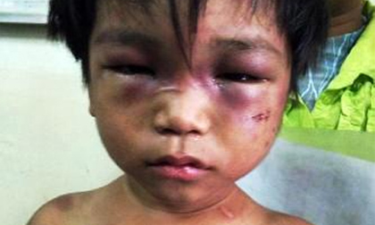 Cậu tra tấn cháu 3 tuổi, loạn luân với chị gái