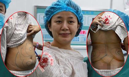 Sao nữ khoe ảnh chuẩn bị "lên bàn mổ" phẫu thuật thẩm mỹ