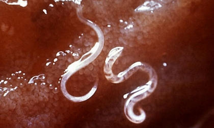 5 loại giun dễ mắc, gây bệnh nguy hiểm cho người