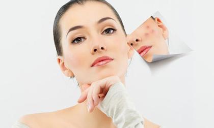 Mặt xinh đón giáng sinh tại Galaxy Spa: Ưu đãi 50% gói trị mụn tận gốc