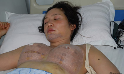 Sau vụ tự tử hụt, diễn viên xứ Đài liên tiếp "khoe" ảnh đi thẩm mỹ