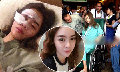 Mỹ nhân Thái suýt hỏng gương mặt vì tai nạn xe nghiêm trọng