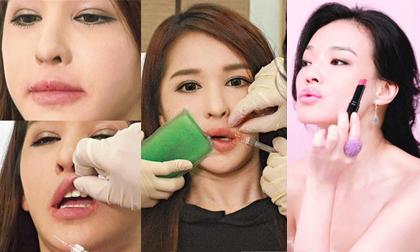 Đau đớn 14 lần châm kim liên tiếp để có làn môi hấp dẫn như Thư Kỳ
