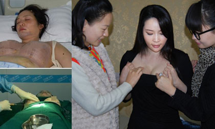 Sau phẫu thuật thẩm mỹ, sao nữ "tự tử hụt" cho kiểm tra ngực công khai