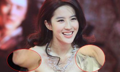 Lưu Diệc Phi lộ "dấu vết" nâng ngực, độn cằm