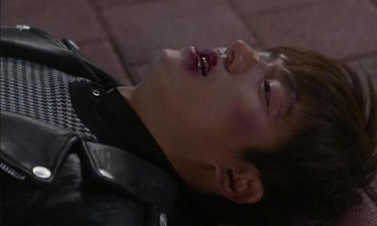 Lee Min Ho bị chấn thương nặng trên phim trường The Heirs