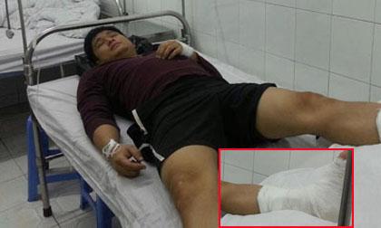 Diễn viên Minh Tiệp ngã ngựa gãy chân phải nằm viện