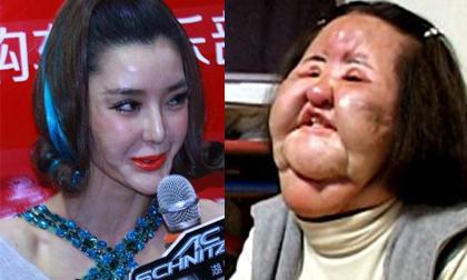 Sao "xấu ma chê quỷ hờn" sau khi thẩm mỹ