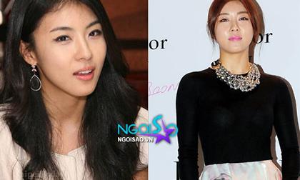 Mặt Ha Ji Won bắt đầu "đơ như sáp" vì botox?
