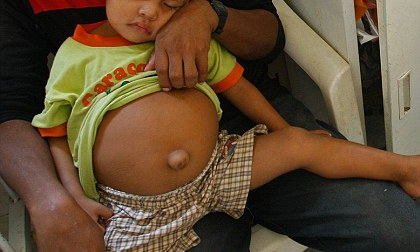 Giật mình bé trai 3 tuổi "mang thai"