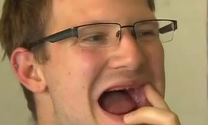 Rụng hết răng do uống 8 lít nước ngọt có ga mỗi ngày