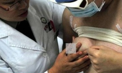 Bị chồng đánh, ngực từ một biến thành hai