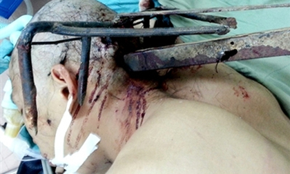 Côn đồ dùng cào sắt bổ vào đầu công an