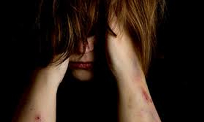 Xát bột ớt vào "vùng kín" của vợ để tra tấn