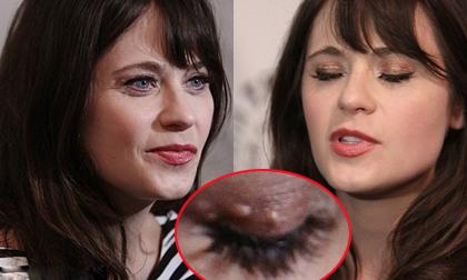 Sao truyền hình Mỹ lộ mí mắt sần sùi đáng sợ