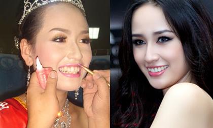 Mỹ nhân Việt "nâng cấp" nhan sắc nhờ hàm răng