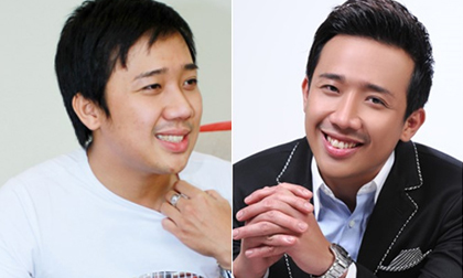 Trấn Thành cũng 'đua đòi' sửa mũi?