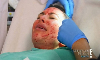 Rùng mình với những cách làm đẹp quái dị