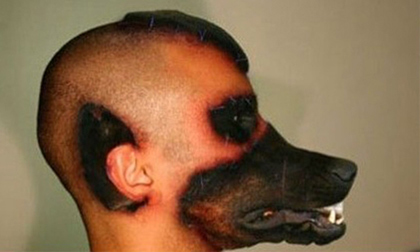 Những ca phẫu thuật kinh khủng nhất thế giới