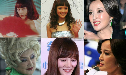 Sao biến dạng "lồi lõm" bởi thẩm mỹ