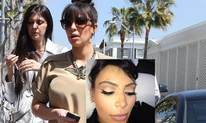 Kim Kardashian lộ ảnh với khuôn mặt đầy kim châm