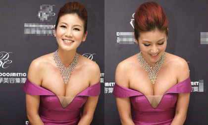 Sao Hoa ngữ khoe vòng một ngồn ngộn sau 'dao kéo'