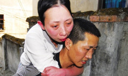 Người phụ nữ mắc bệnh lạ, ngủ quá một tiếng sẽ chết