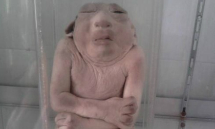 Ghê rợn hình ảnh nghiên cứu cơ thể người chết