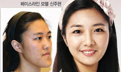 Chùm ảnh: Đẹp không tì vết nhờ công nghệ phẫu thuật thẩm mỹ 