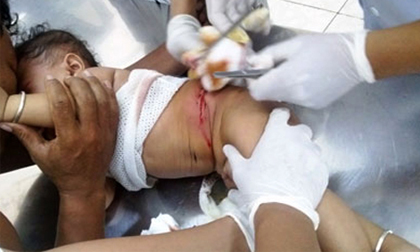 Cháu bé 6 tháng tuổi bị chém trọng thương