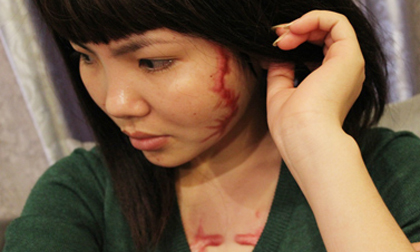 Cô gái bị xăm quái vật vào mặt và ngực nhận 400 triệu bồi thường